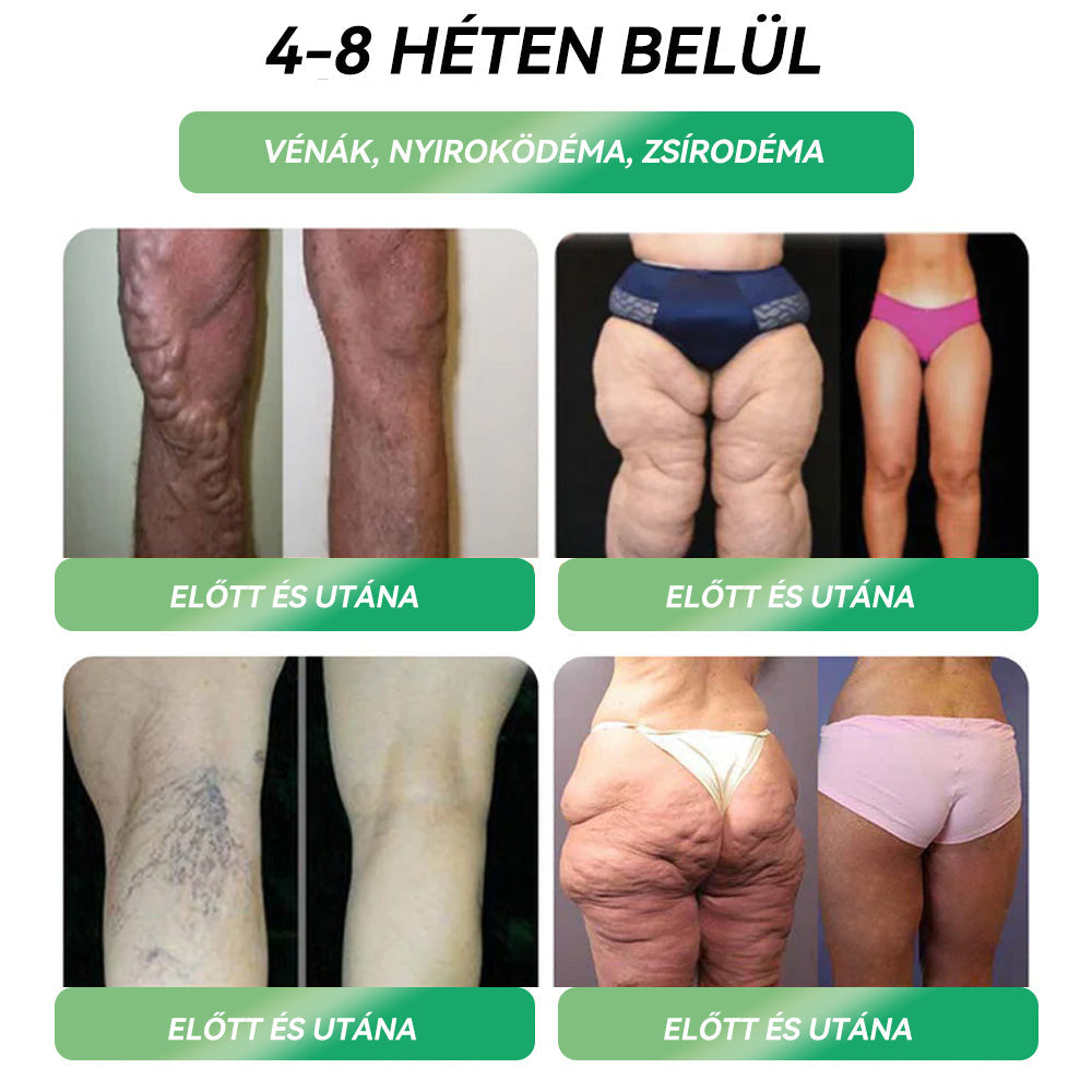 🔥Semmelweis Egyetemi Kórház Ajánlásai |hivatalos áruház |💗💯𝐒𝐓𝐃™ 𝐆𝐋𝐏-𝟏 𝐅𝐨𝐠𝐲á𝐬 𝐒𝐳á𝐣𝐨𝐧 á𝐭 𝐚𝐥𝐤𝐚𝐥𝐦𝐚𝐳𝐡𝐚𝐭ó 𝐨𝐥𝐝𝐚𝐭 - 👨‍⚕️ Elhízás, szív- és érrendszeri betegségek, cukorbetegség, alvási apnoe, ízületi problémák és egyebek